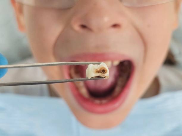 Best Emergency Dentist for Knocked-Out Tooth in Fennville, MI