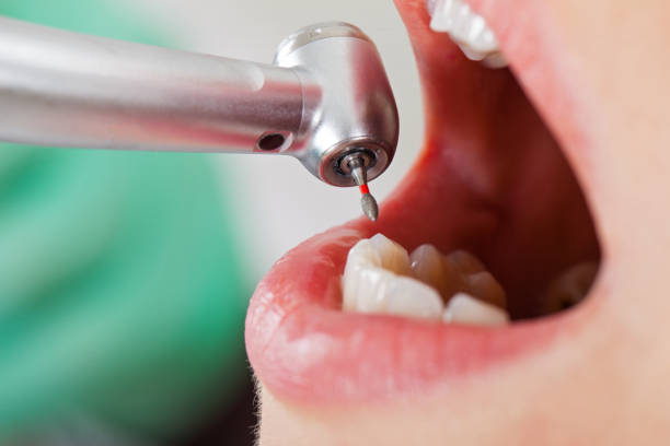 Best Holiday Emergency Dentist in Fennville, MI